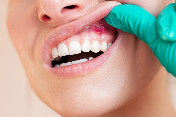 How Tooth Decay And Gum Disease Are Connected